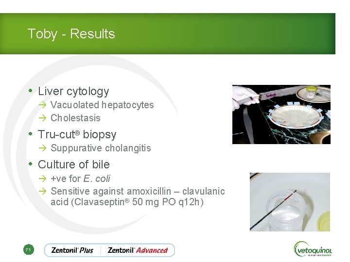 Toby - Results • Liver cytology à Vacuolated hepatocytes à Cholestasis • Tru-cut® biopsy