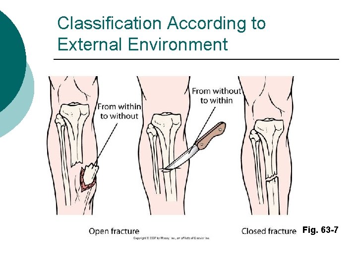 Classification According to External Environment Fig. 63 -7 