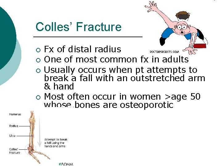 Colles’ Fracture ¡ ¡ Fx of distal radius One of most common fx in