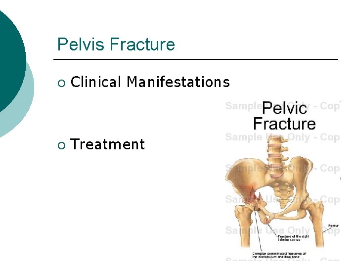 Pelvis Fracture ¡ Clinical Manifestations ¡ Treatment 