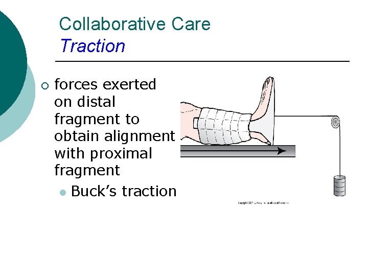 Collaborative Care Traction ¡ forces exerted on distal fragment to obtain alignment with proximal