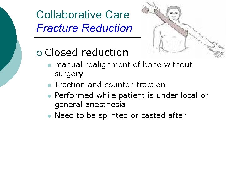 Collaborative Care Fracture Reduction ¡ Closed l l reduction manual realignment of bone without