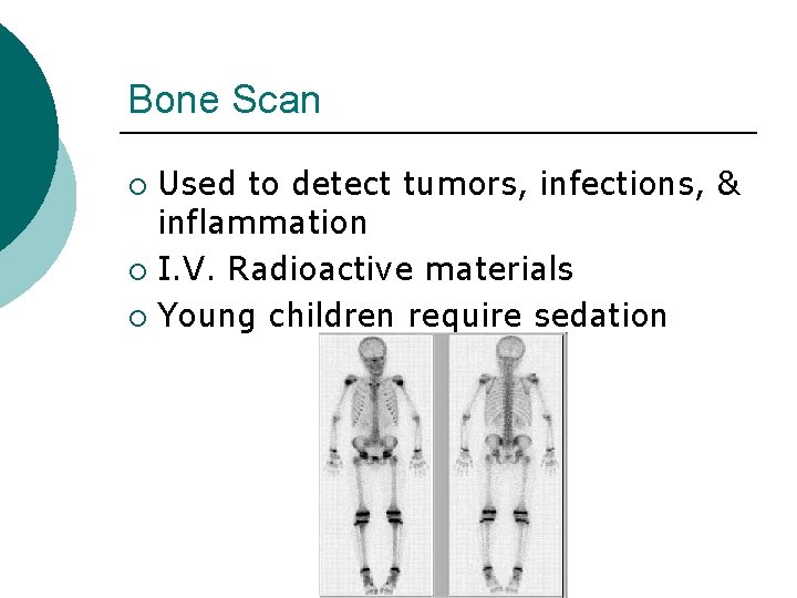 Bone Scan Used to detect tumors, infections, & inflammation ¡ I. V. Radioactive materials