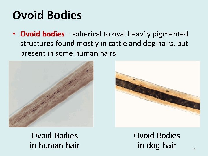 Ovoid Bodies • Ovoid bodies – spherical to oval heavily pigmented structures found mostly