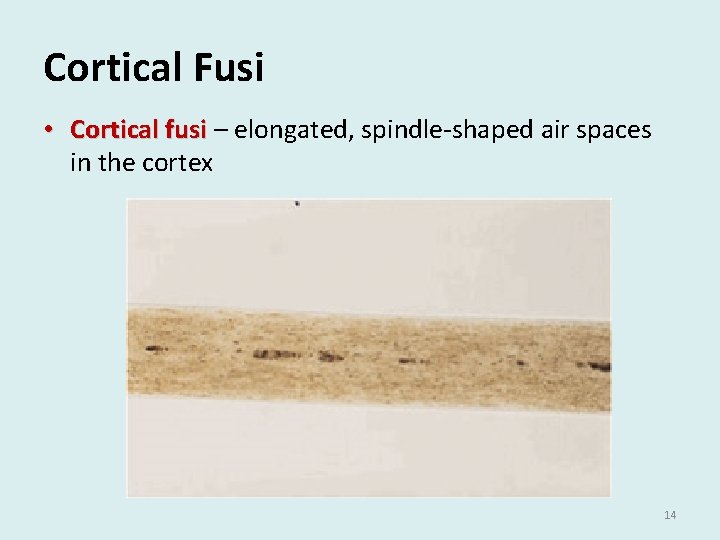 Cortical Fusi • Cortical fusi – elongated, spindle-shaped air spaces in the cortex 14