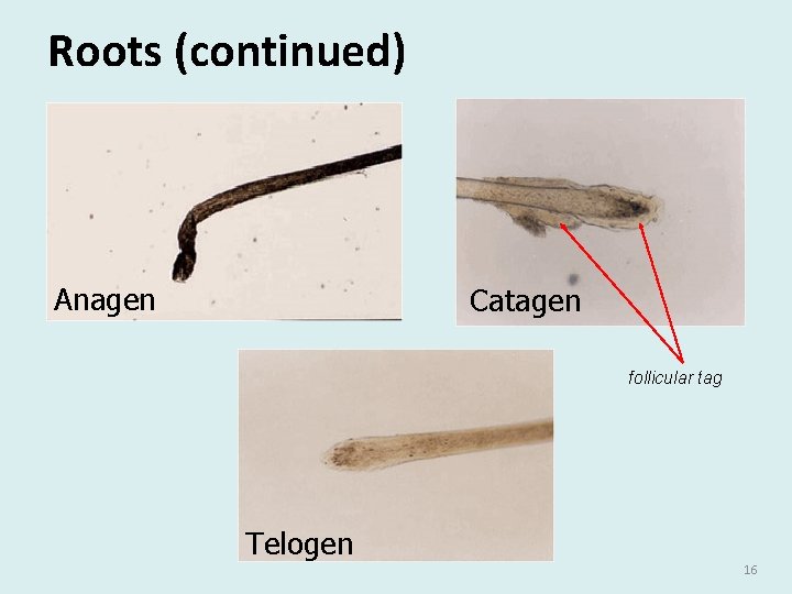 Roots (continued) Anagen Catagen follicular tag Telogen 16 