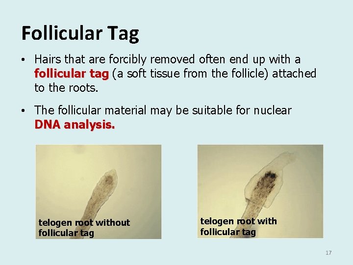 Follicular Tag • Hairs that are forcibly removed often end up with a follicular Follicular Tag • Hairs that are forcibly removed often end up with a follicular