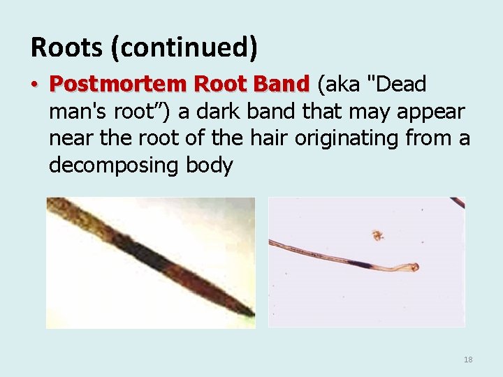 Roots (continued) • Postmortem Root Band (aka "Dead man's root”) a dark band that Roots (continued) • Postmortem Root Band (aka "Dead man's root”) a dark band that