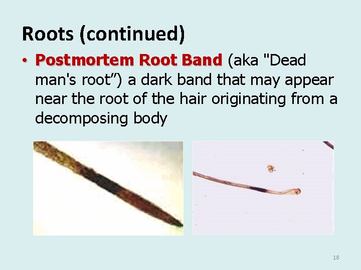 Roots (continued) • Postmortem Root Band (aka "Dead man's root”) a dark band that