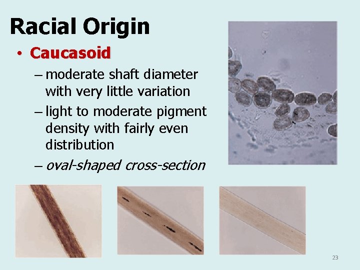 Racial Origin • Caucasoid – moderate shaft diameter with very little variation – light