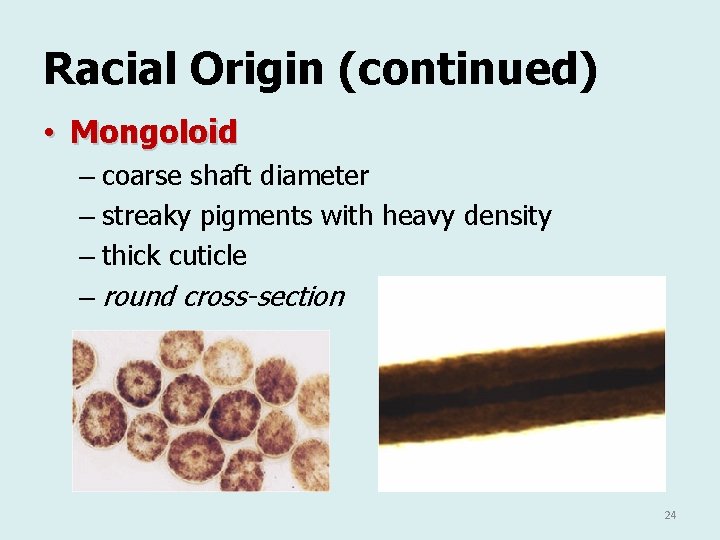 Racial Origin (continued) • Mongoloid – coarse shaft diameter – streaky pigments with heavy