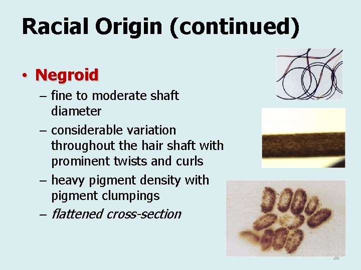 Racial Origin (continued) • Negroid – fine to moderate shaft diameter – considerable variation