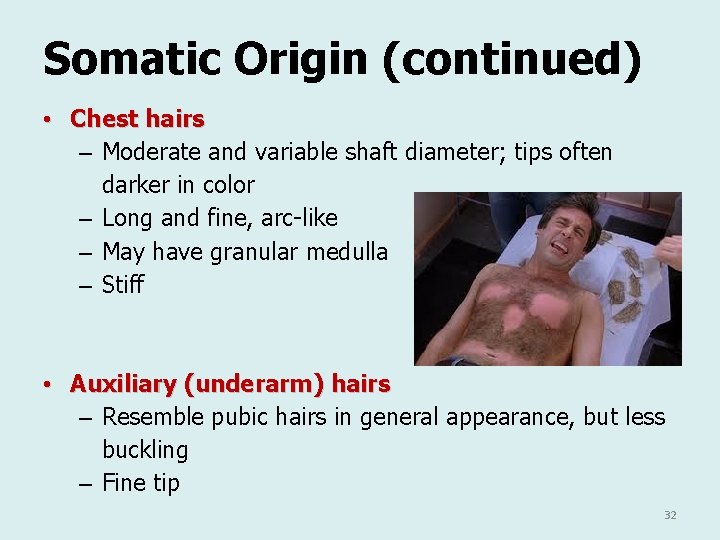 Somatic Origin (continued) • Chest hairs – Moderate and variable shaft diameter; tips often