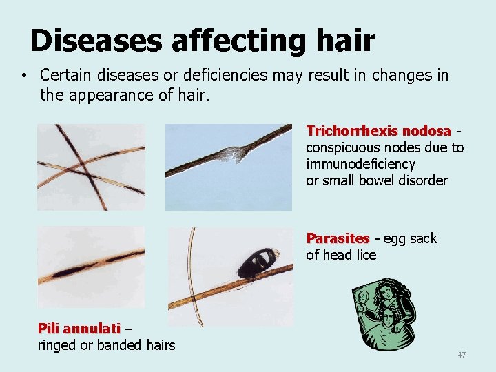 Diseases affecting hair • Certain diseases or deficiencies may result in changes in the