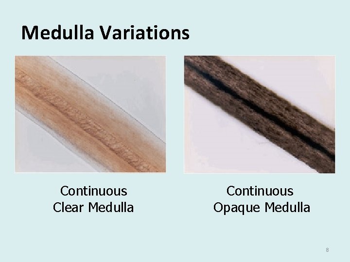 Medulla Variations Continuous Clear Medulla Continuous Opaque Medulla 8 