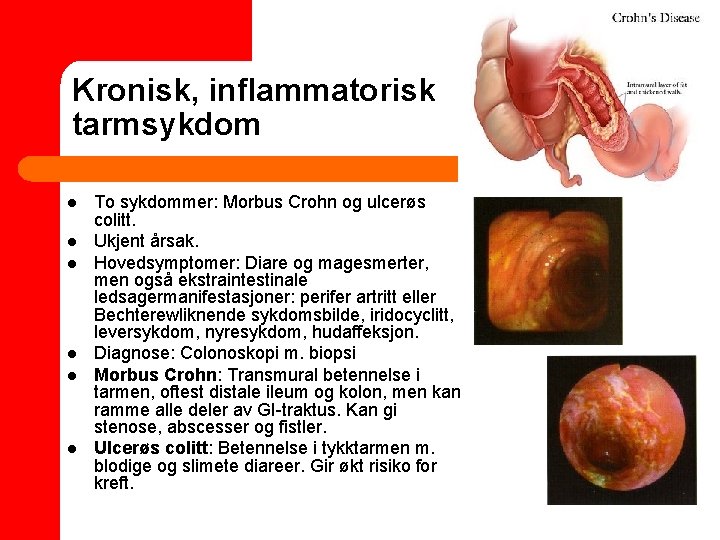Kronisk, inflammatorisk tarmsykdom l l l To sykdommer: Morbus Crohn og ulcerøs colitt. Ukjent