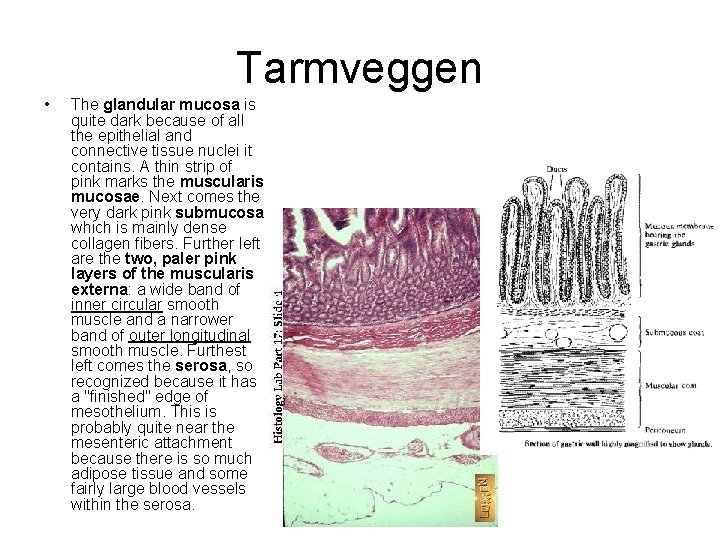 Tarmveggen • The glandular mucosa is quite dark because of all the epithelial and