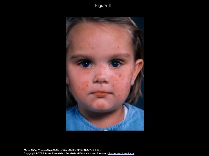 Figure 10 Mayo Clinic Proceedings 2002 77825 -836 DOI: (10. 4065/77. 8. 825) Copyright