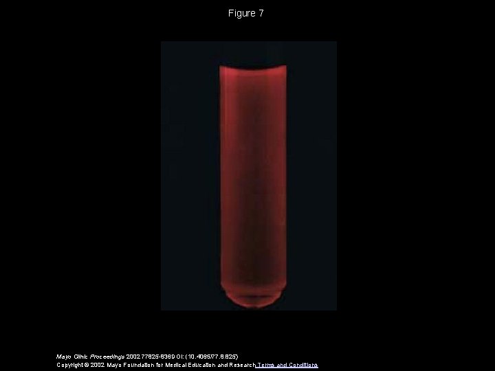 Figure 7 Mayo Clinic Proceedings 2002 77825 -836 DOI: (10. 4065/77. 8. 825) Copyright