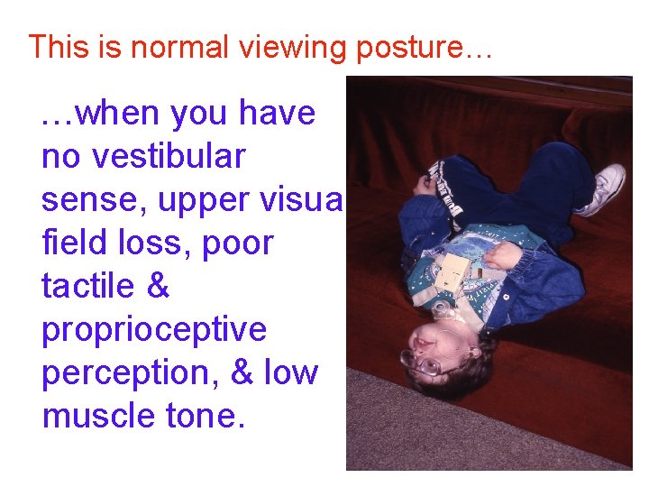 This is normal viewing posture… …when you have no vestibular sense, upper visual field This is normal viewing posture… …when you have no vestibular sense, upper visual field
