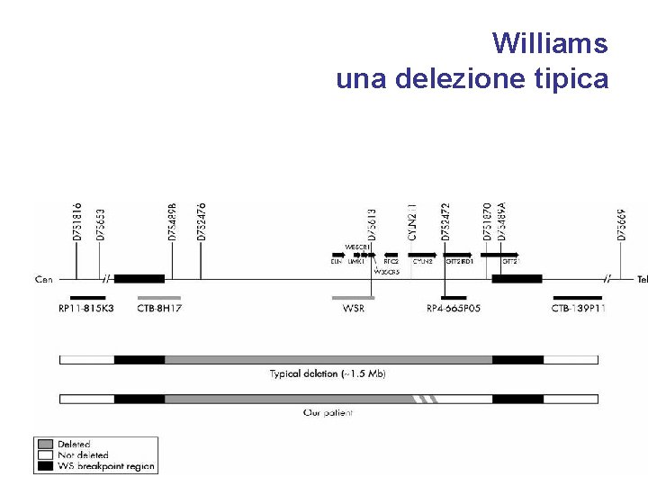 Williams una delezione tipica 