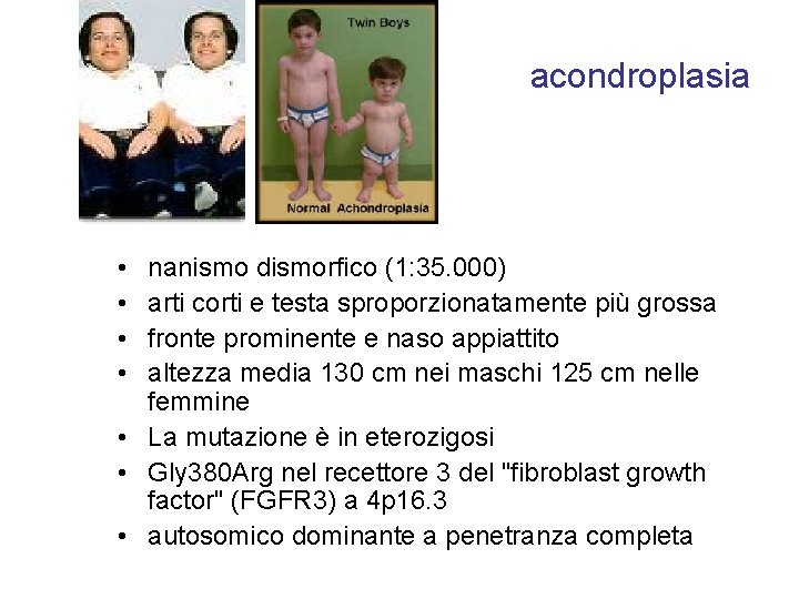 acondroplasia • • nanismo dismorfico (1: 35. 000) arti corti e testa sproporzionatamente più
