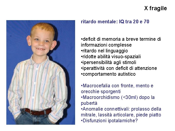 X fragile ritardo mentale: IQ tra 20 e 70 • deficit di memoria a