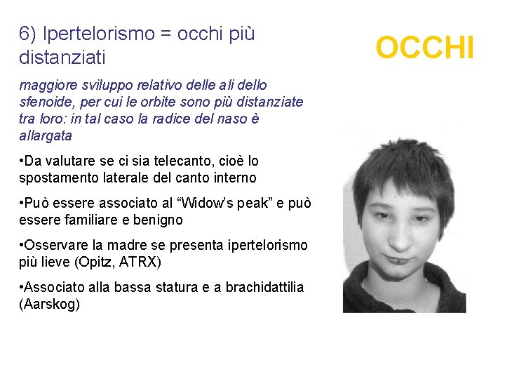 6) Ipertelorismo = occhi più distanziati maggiore sviluppo relativo delle ali dello sfenoide, per