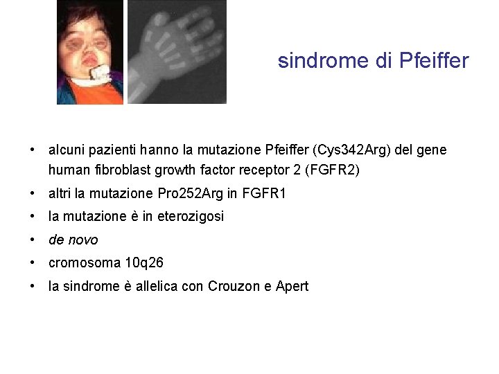 sindrome di Pfeiffer • alcuni pazienti hanno la mutazione Pfeiffer (Cys 342 Arg) del