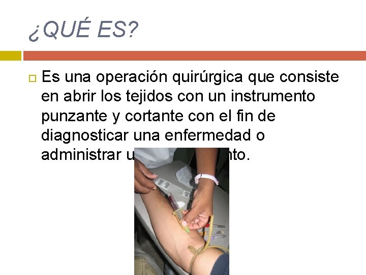 ¿QUÉ ES? Es una operación quirúrgica que consiste en abrir los tejidos con un