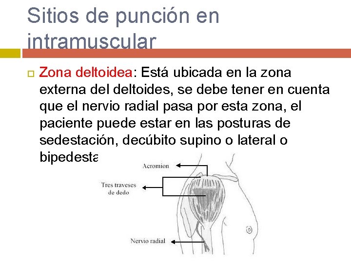 Sitios de punción en intramuscular Zona deltoidea: Está ubicada en la zona externa deltoides,