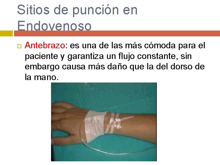 Sitios de punción en Endovenoso Antebrazo: es una de las más cómoda para el