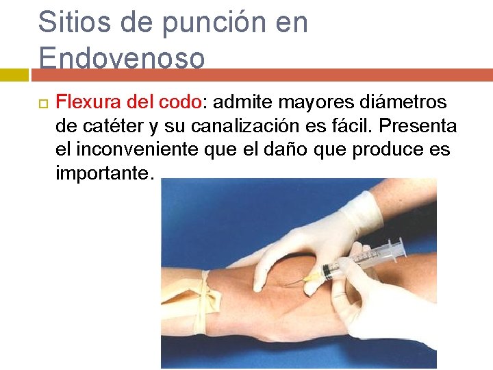 Sitios de punción en Endovenoso Flexura del codo: admite mayores diámetros de catéter y