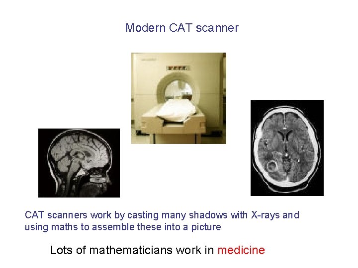 Modern CAT scanners work by casting many shadows with X-rays and using maths to