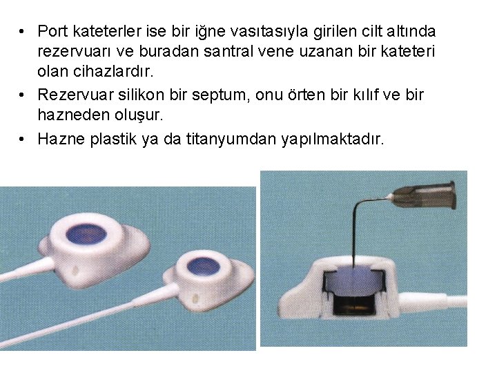  • Port kateterler ise bir iğne vasıtasıyla girilen cilt altında rezervuarı ve buradan