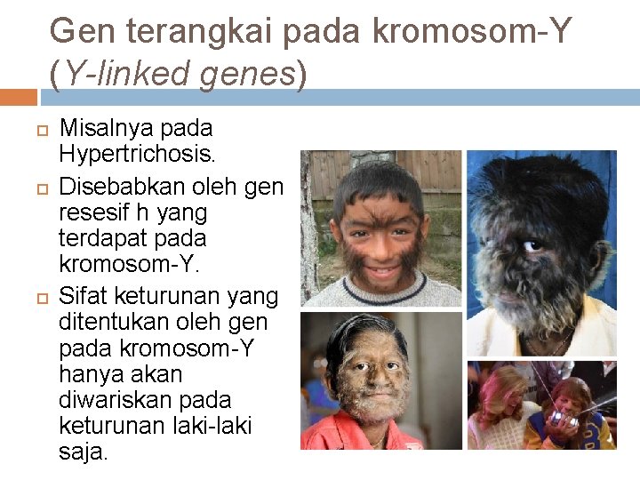 Gen terangkai pada kromosom-Y (Y-linked genes) Misalnya pada Hypertrichosis. Disebabkan oleh gen resesif h