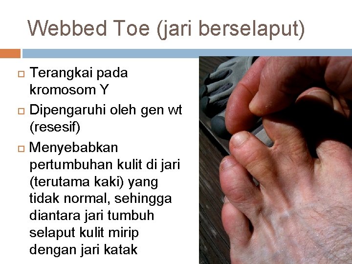 Webbed Toe (jari berselaput) Terangkai pada kromosom Y Dipengaruhi oleh gen wt (resesif) Menyebabkan