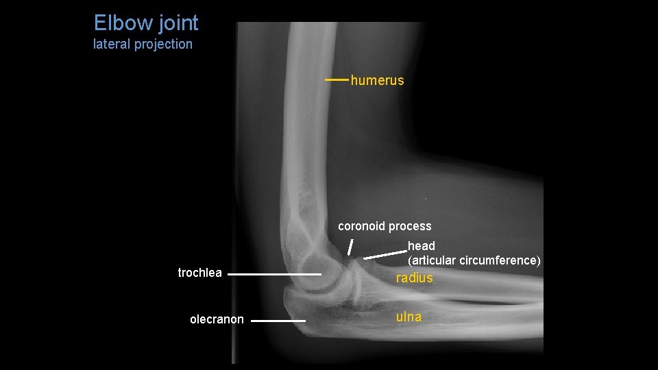 Elbow joint lateral projection humerus coronoid process trochlea olecranon head (articular circumference) radius ulna