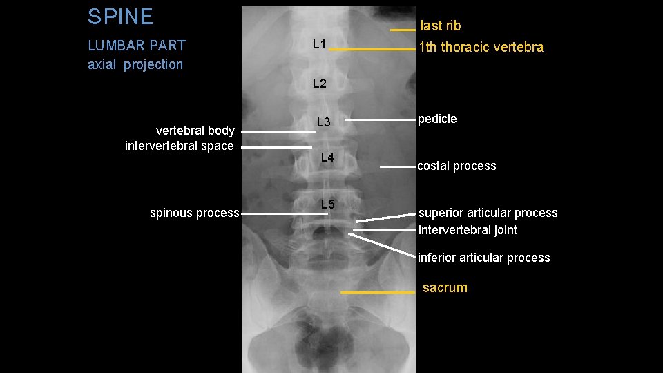 SPINE LUMBAR PART axial projection last rib L 1 1 th thoracic vertebra L