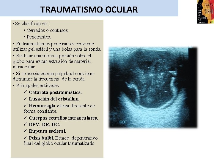 TRAUMATISMO OCULAR • Se clasifican en: • Cerrados o contusos. • Penetrantes. • En