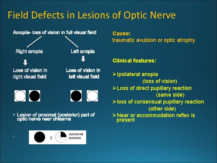 Field Defects in Lesions of Optic Nerve Cause: traumatic avulsion or optic atrophy Clinical