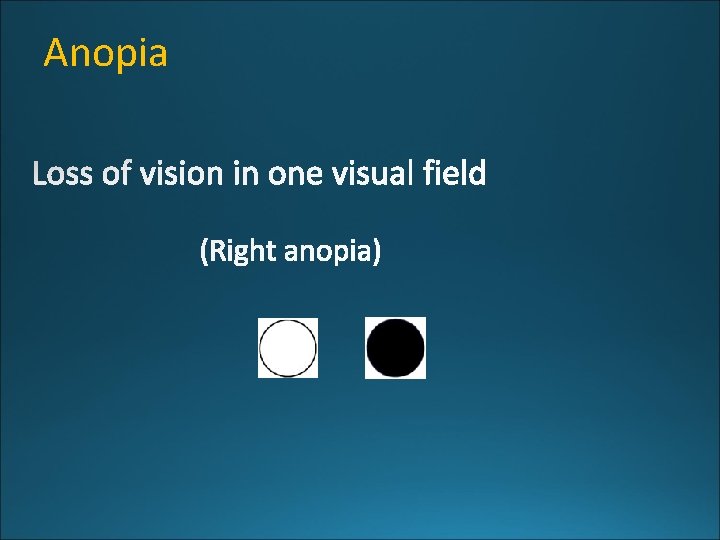 Anopia 