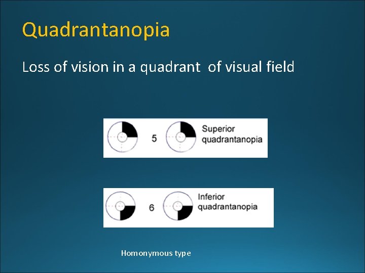 Quadrantanopia Loss of vision in a quadrant of visual field Homonymous type 