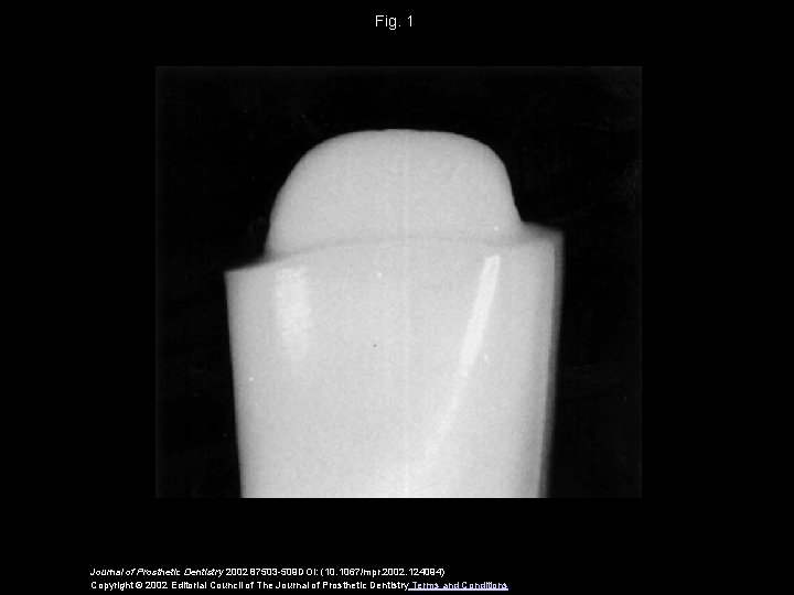 Fig. 1 Journal of Prosthetic Dentistry 2002 87503 -509 DOI: (10. 1067/mpr. 2002. 124094)