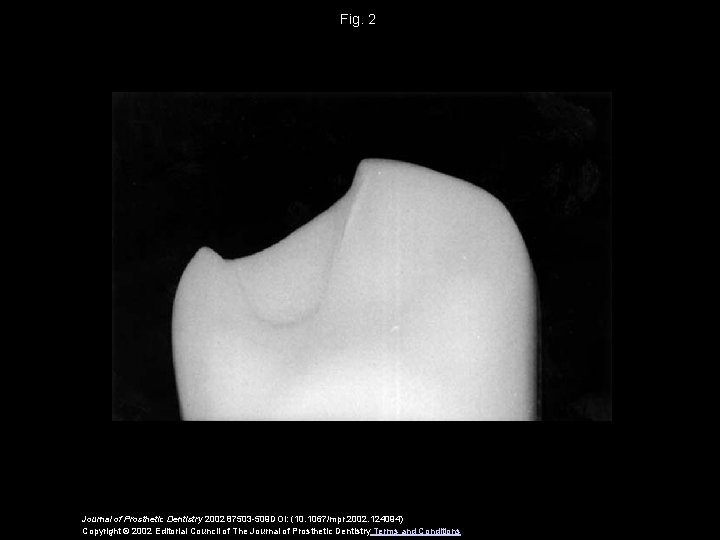 Fig. 2 Journal of Prosthetic Dentistry 2002 87503 -509 DOI: (10. 1067/mpr. 2002. 124094)