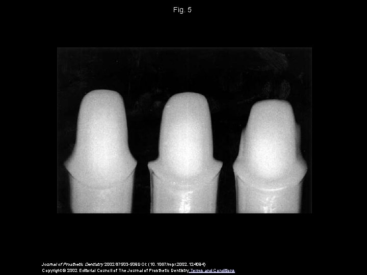 Fig. 5 Journal of Prosthetic Dentistry 2002 87503 -509 DOI: (10. 1067/mpr. 2002. 124094)