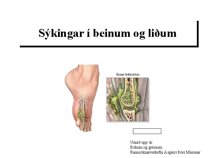 Sýkingar í beinum og liðum Unnið upp úr: Bókum og greinum Rannsóknarverkefni Ásgeirs Þórs