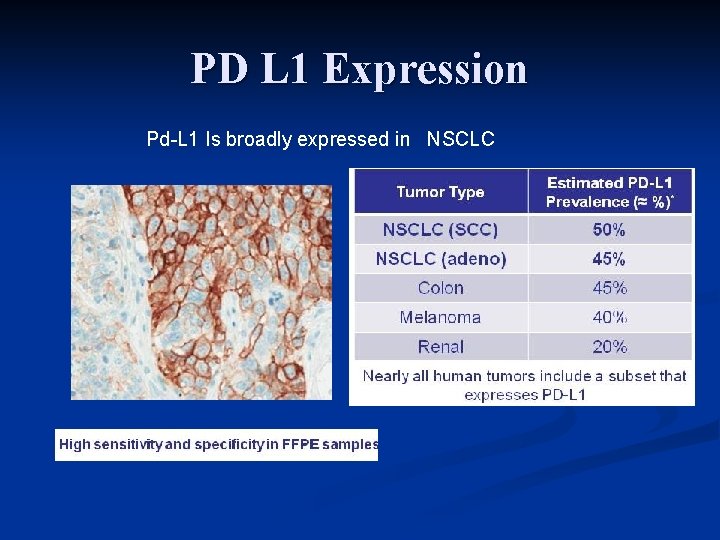 PD L 1 Expression Pd-L 1 Is broadly expressed in NSCLC 