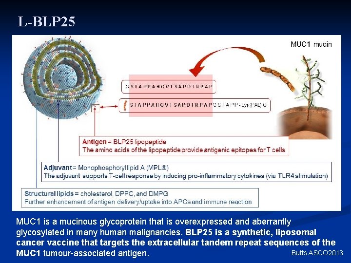 L-BLP 25 MUC 1 is a mucinous glycoprotein that is overexpressed and aberrantly glycosylated