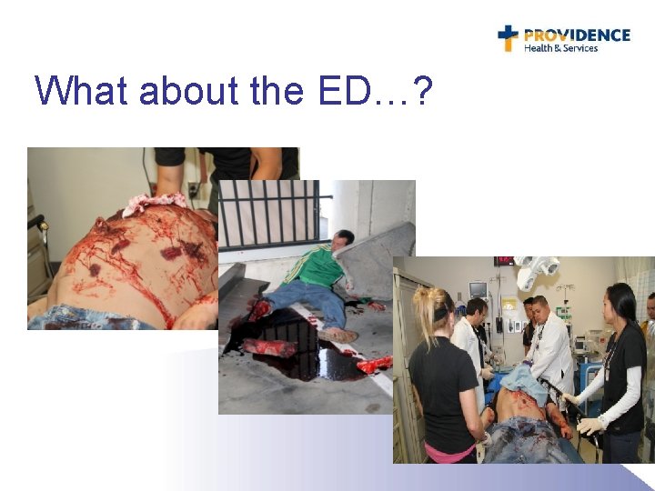 What about the ED…? 